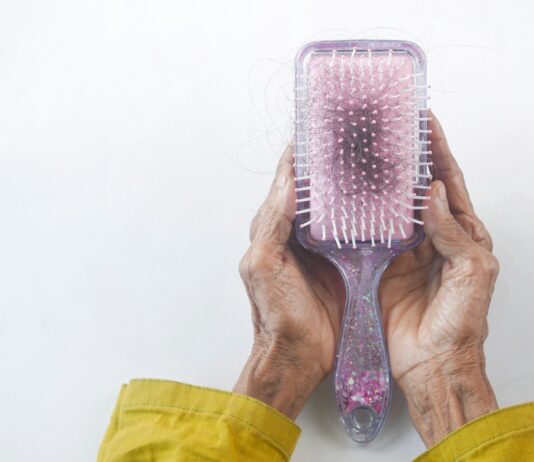 “요즘 머리가 너무 자주 빠져요”… 환절기 탈모는 어떻게 관리할까요? a person holding a hair brush in their hands