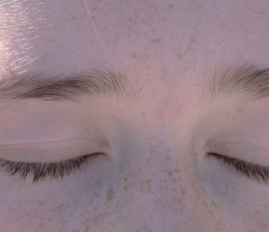 스트레스, 이제는 ‘조금씩 내려놓는 연습’이 대세 a close up of a person's eyes with freckled hair